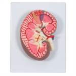 Human Kidney Model