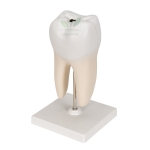 Human Teeth Model, Lower Molar with One Root